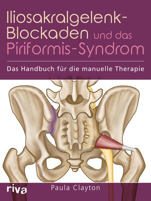 cover image of Iliosakralgelenk-Blockaden und das Piriformis-Syndrom